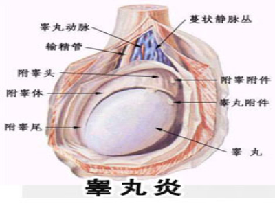 睪丸炎給男性帶來(lái)哪些危害